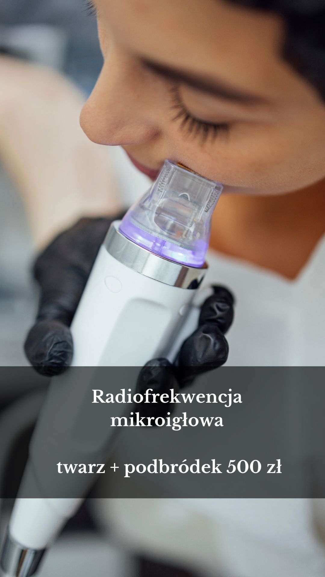 Radiofrekwencja mikroigłowa